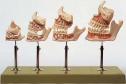 歯列発育模型