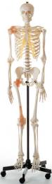 人体骨格模型(靭帯付)